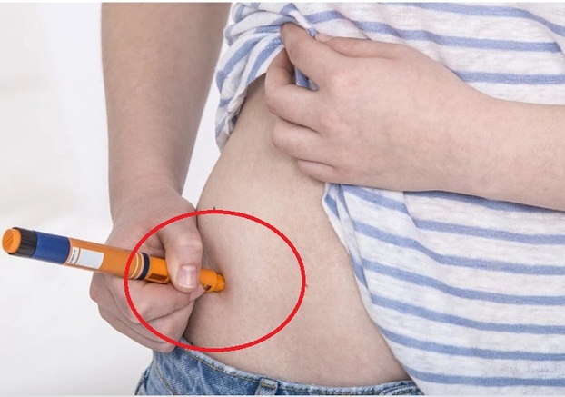 Tiêm insulin sai cách có thể gây nguy hiểm cho người bị đái tháo đường. Ảnh minh họa